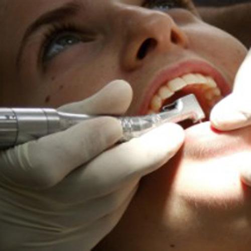 15-syneron-dentist