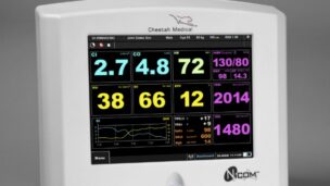 A nurse can easily hook up this NICOM monitor by sticking leads on a patient's skin.