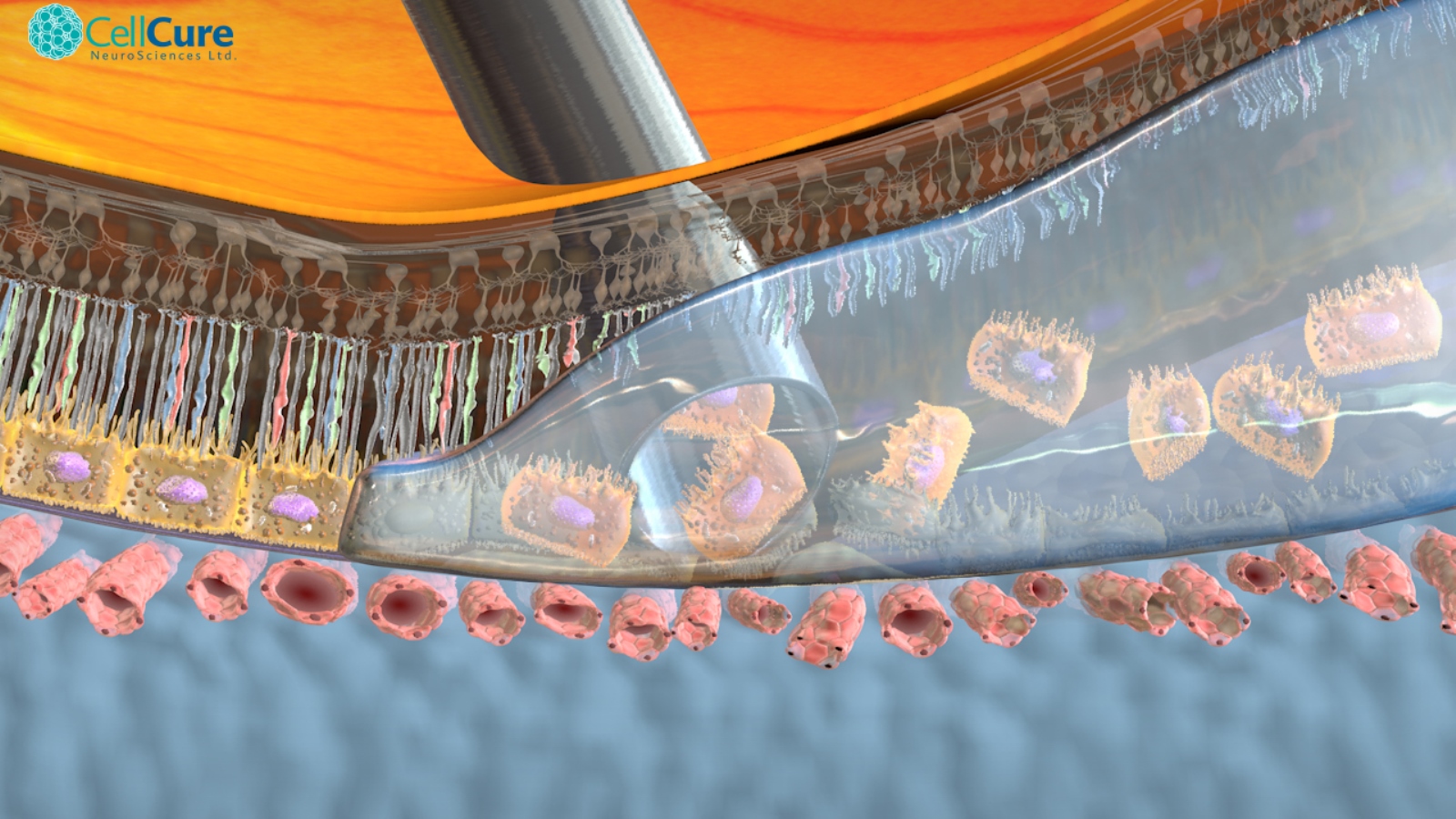 OpRegen being injected into a degenerating retina. Image courtesy of Cell Cure Neurosciences