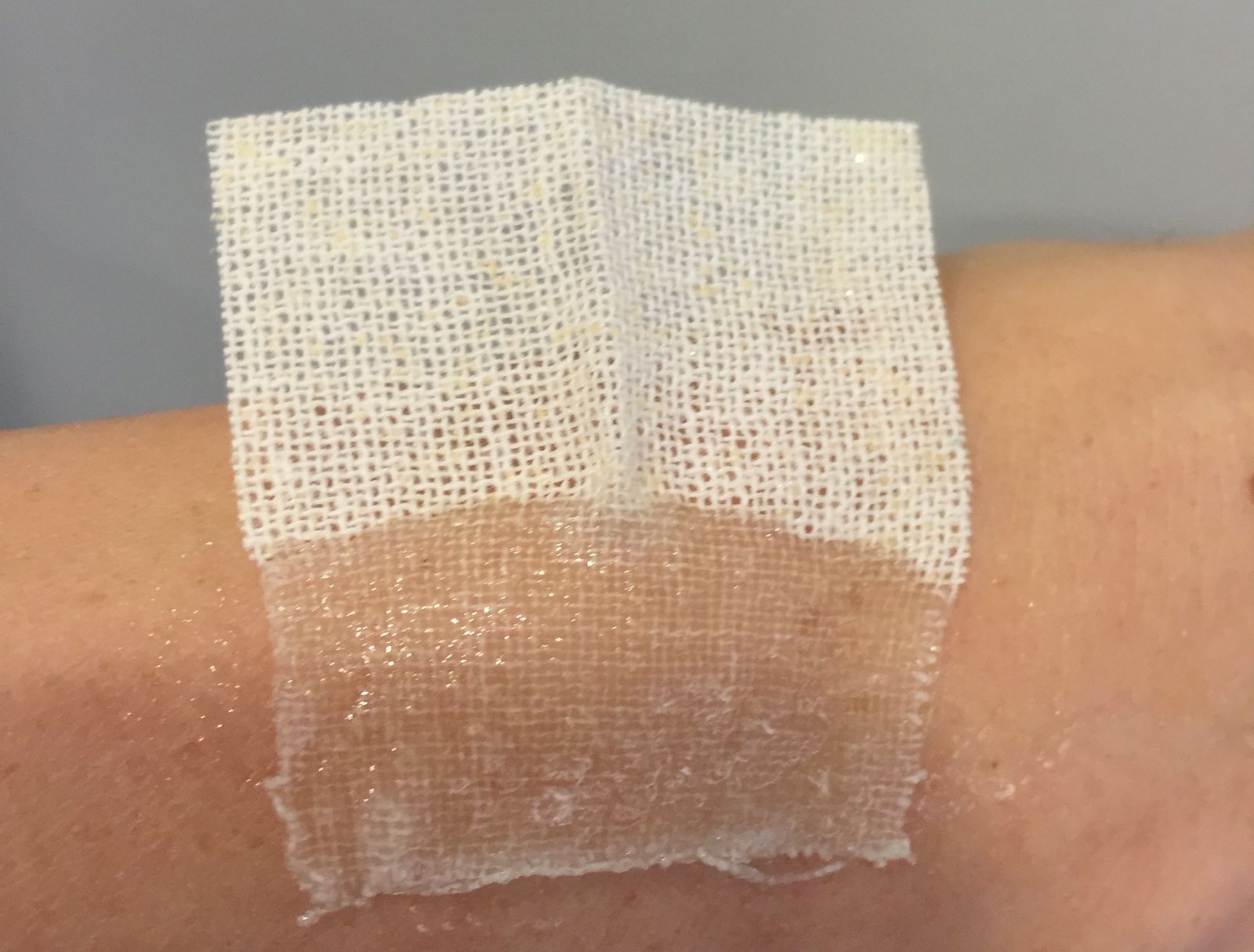 WoundClot gauze forms a gel membrane with the bloodâ€™s own clotting factors. Photo: courtesy
