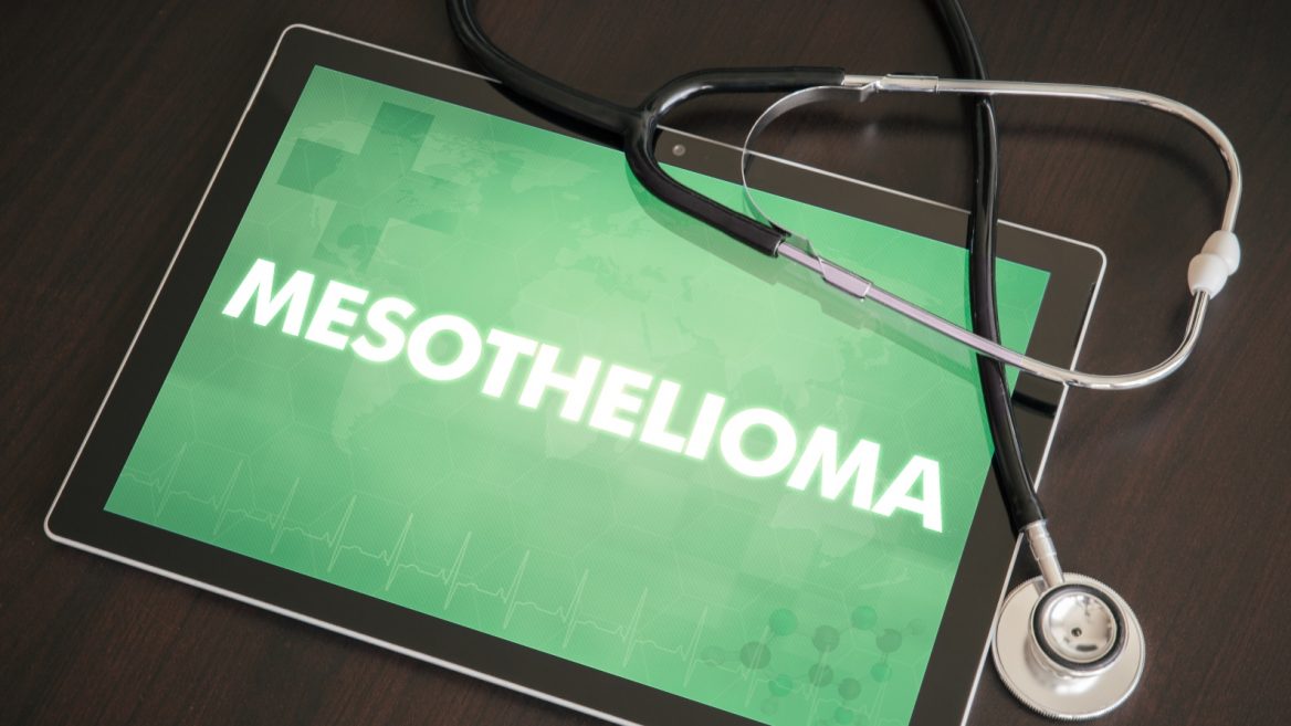 how mesothelioma is diagnosed