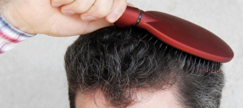 Stress detection through hair follicles