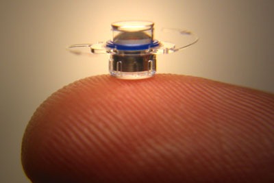 A telephoto ocular prosthesis. The central optical portion is a micro-lens system that renders a magnified image on the retina. Photo courtesy of VisionCare